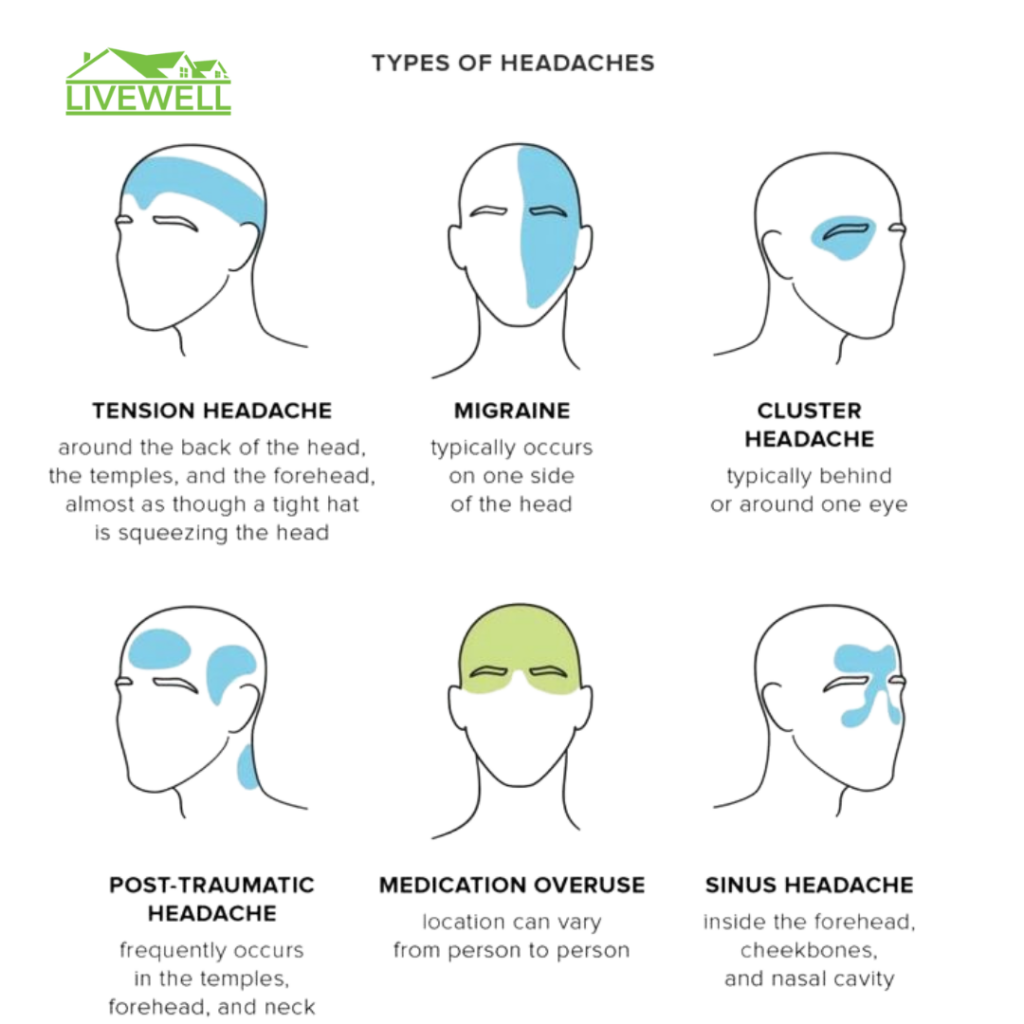 Tupes of Headaches